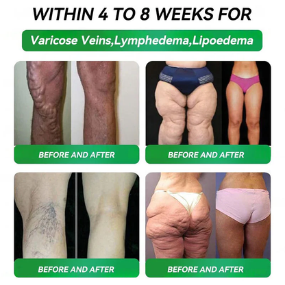 𝑶𝒇𝒇𝒊𝒄𝒊𝒂𝒍 𝑺𝒕𝒐𝒓𝒆🇺🇸 |𝙋𝙄𝙂𝙐𝙄𝘼𝙔®𝐺𝐿𝑃-𝟏  𝑺𝑰𝑿-𝑰𝑵-𝑶𝑵𝑬 𝑯𝒆𝒂𝒍𝒕𝒉 𝑺𝒐𝒍𝒖𝒕𝒊𝒐𝒏 𝑶𝒓𝒂𝒍 𝑳𝒊𝒒𝒖𝒊𝒅  (𝐉𝐮𝐬𝐭 𝐨𝐧𝐜𝐞 𝐚 𝐝𝐚𝐲, 𝐯𝐢𝐬𝐢𝐛𝐥𝐞 𝐜𝐡𝐚𝐧𝐠𝐞𝐬 𝐢𝐧 𝟕 𝐝𝐚𝐲𝐬）𝐅𝐨𝐫 𝐨𝐛𝐞𝐬𝐢𝐭𝐲, 𝐜𝐚𝐫𝐝𝐢𝐨𝐯𝐚𝐬𝐜𝐮𝐥𝐚𝐫 𝐡𝐞𝐚𝐥𝐭𝐡, 𝐝𝐢𝐚𝐛𝐞𝐭𝐞𝐬, 𝐬𝐥𝐞𝐞𝐩 𝐚𝐩𝐧𝐞𝐚, 𝐆𝐮𝐭 𝐇𝐞𝐚𝐥𝐭𝐡, 𝐣𝐨𝐢𝐧𝐭 𝐢𝐬𝐬𝐮𝐞𝐬, 𝐚𝐧𝐝 𝐦𝐨𝐫𝐞🎄