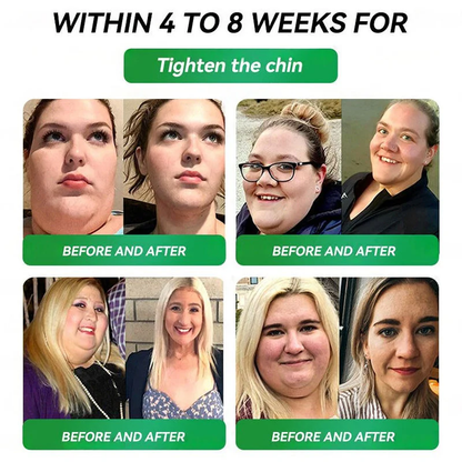 𝑶𝒇𝒇𝒊𝒄𝒊𝒂𝒍 𝑺𝒕𝒐𝒓𝒆🇺🇸 |𝙋𝙄𝙂𝙐𝙄𝘼𝙔®𝐺𝐿𝑃-𝟏  𝑺𝑰𝑿-𝑰𝑵-𝑶𝑵𝑬 𝑯𝒆𝒂𝒍𝒕𝒉 𝑺𝒐𝒍𝒖𝒕𝒊𝒐𝒏 𝑶𝒓𝒂𝒍 𝑳𝒊𝒒𝒖𝒊𝒅  (𝐉𝐮𝐬𝐭 𝐨𝐧𝐜𝐞 𝐚 𝐝𝐚𝐲, 𝐯𝐢𝐬𝐢𝐛𝐥𝐞 𝐜𝐡𝐚𝐧𝐠𝐞𝐬 𝐢𝐧 𝟕 𝐝𝐚𝐲𝐬）𝐅𝐨𝐫 𝐨𝐛𝐞𝐬𝐢𝐭𝐲, 𝐜𝐚𝐫𝐝𝐢𝐨𝐯𝐚𝐬𝐜𝐮𝐥𝐚𝐫 𝐡𝐞𝐚𝐥𝐭𝐡, 𝐝𝐢𝐚𝐛𝐞𝐭𝐞𝐬, 𝐬𝐥𝐞𝐞𝐩 𝐚𝐩𝐧𝐞𝐚, 𝐆𝐮𝐭 𝐇𝐞𝐚𝐥𝐭𝐡, 𝐣𝐨𝐢𝐧𝐭 𝐢𝐬𝐬𝐮𝐞𝐬, 𝐚𝐧𝐝 𝐦𝐨𝐫𝐞🎄