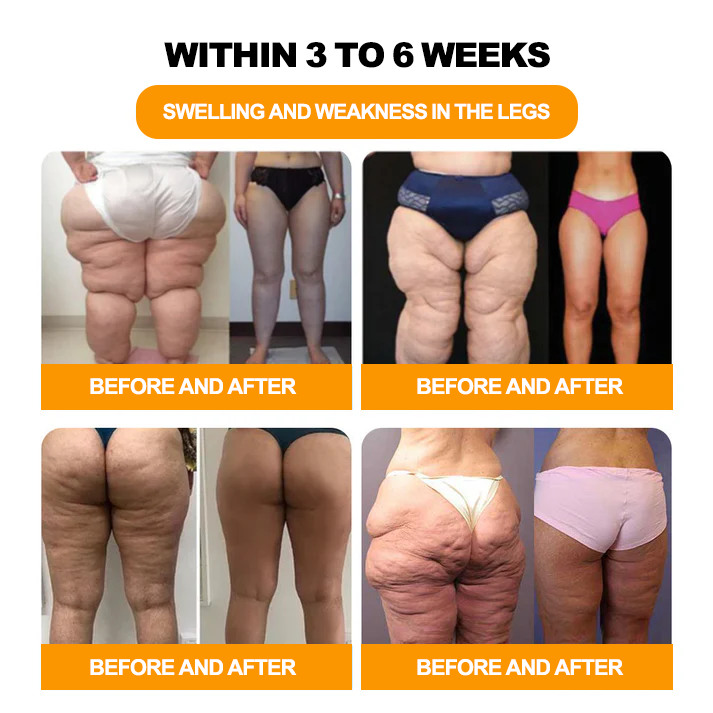 Piguiay®GLP-1 Slimming& Detox Foot Bath Beads-🌿(𝐋𝐀𝐍𝐀 𝐂𝐞𝐫𝐭𝐢𝐟𝐢𝐜𝐚𝐭𝐢𝐨𝐧，𝗟𝘆𝗺𝗽𝗵𝗮𝘁𝗶𝗰 𝗔𝘀𝘀𝗼𝗰𝗶𝗮𝘁𝗶𝗼𝗻 𝗼𝗳 𝐂𝐚𝐧𝐚𝐝𝐚)