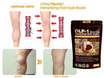 Piguiay®GLP-1 Slimming& Detox Foot Bath Beads-🌿(𝐋𝐀𝐍𝐀 𝐂𝐞𝐫𝐭𝐢𝐟𝐢𝐜𝐚𝐭𝐢𝐨𝐧，𝗟𝘆𝗺𝗽𝗵𝗮𝘁𝗶𝗰 𝗔𝘀𝘀𝗼𝗰𝗶𝗮𝘁𝗶𝗼𝗻 𝗼𝗳 𝐂𝐚𝐧𝐚𝐝𝐚)