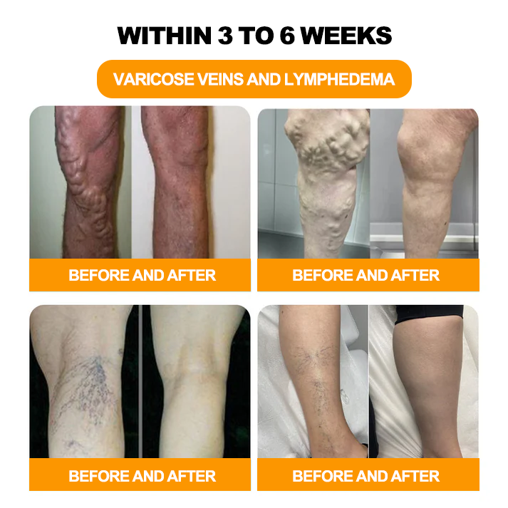 Piguiay®GLP-1 Slimming& Detox Foot Bath Beads-🌿(𝐋𝐀𝐍𝐀 𝐂𝐞𝐫𝐭𝐢𝐟𝐢𝐜𝐚𝐭𝐢𝐨𝐧，𝗟𝘆𝗺𝗽𝗵𝗮𝘁𝗶𝗰 𝗔𝘀𝘀𝗼𝗰𝗶𝗮𝘁𝗶𝗼𝗻 𝗼𝗳 𝐂𝐚𝐧𝐚𝐝𝐚)