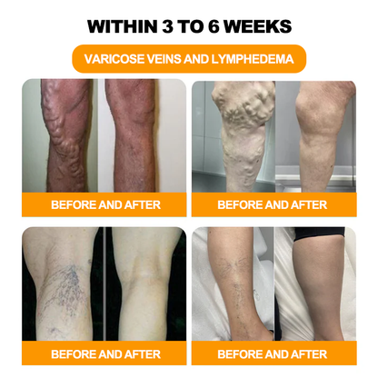 Piguiay®GLP-1 Slimming& Detox Foot Bath Beads-🌿(𝐋𝐀𝐍𝐀 𝐂𝐞𝐫𝐭𝐢𝐟𝐢𝐜𝐚𝐭𝐢𝐨𝐧，𝗟𝘆𝗺𝗽𝗵𝗮𝘁𝗶𝗰 𝗔𝘀𝘀𝗼𝗰𝗶𝗮𝘁𝗶𝗼𝗻 𝗼𝗳 𝐂𝐚𝐧𝐚𝐝𝐚)