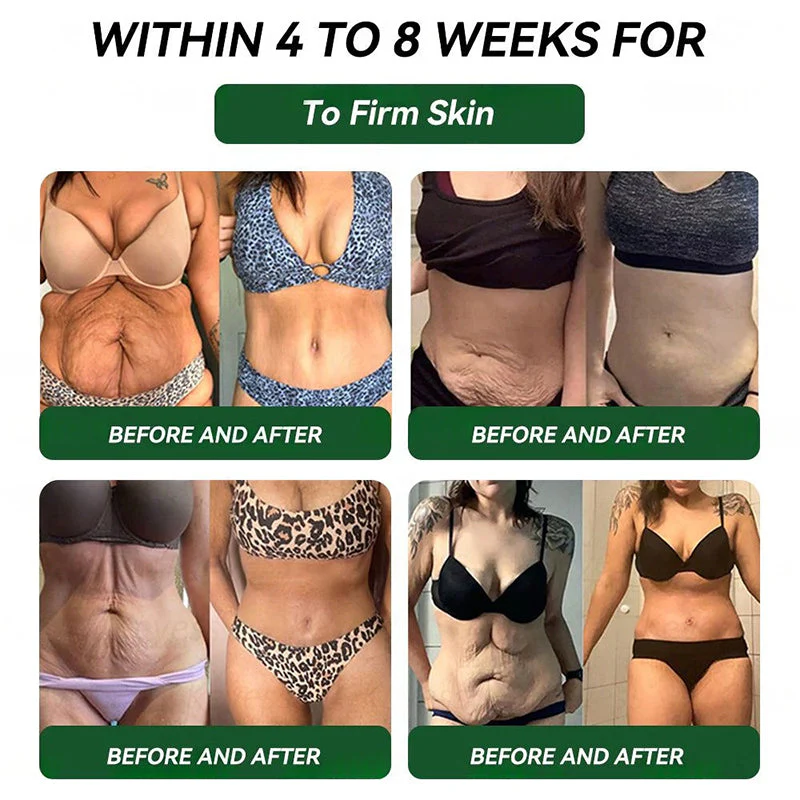 𝑶𝒇𝒇𝒊𝒄𝒊𝒂𝒍 𝑺𝒕𝒐𝒓𝒆🇺🇸 |𝙋𝙄𝙂𝙐𝙄𝘼𝙔®𝐺𝐿𝑃-𝟏  𝑺𝑰𝑿-𝑰𝑵-𝑶𝑵𝑬 𝑯𝒆𝒂𝒍𝒕𝒉 𝑺𝒐𝒍𝒖𝒕𝒊𝒐𝒏 𝑶𝒓𝒂𝒍 𝑳𝒊𝒒𝒖𝒊𝒅  (𝐉𝐮𝐬𝐭 𝐨𝐧𝐜𝐞 𝐚 𝐝𝐚𝐲, 𝐯𝐢𝐬𝐢𝐛𝐥𝐞 𝐜𝐡𝐚𝐧𝐠𝐞𝐬 𝐢𝐧 𝟕 𝐝𝐚𝐲𝐬）𝐅𝐨𝐫 𝐨𝐛𝐞𝐬𝐢𝐭𝐲, 𝐜𝐚𝐫𝐝𝐢𝐨𝐯𝐚𝐬𝐜𝐮𝐥𝐚𝐫 𝐡𝐞𝐚𝐥𝐭𝐡, 𝐝𝐢𝐚𝐛𝐞𝐭𝐞𝐬, 𝐬𝐥𝐞𝐞𝐩 𝐚𝐩𝐧𝐞𝐚, 𝐆𝐮𝐭 𝐇𝐞𝐚𝐥𝐭𝐡, 𝐣𝐨𝐢𝐧𝐭 𝐢𝐬𝐬𝐮𝐞𝐬, 𝐚𝐧𝐝 𝐦𝐨𝐫𝐞🎄